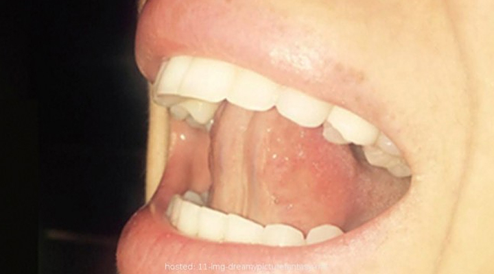 Картинки по запросу язык прижать к небу