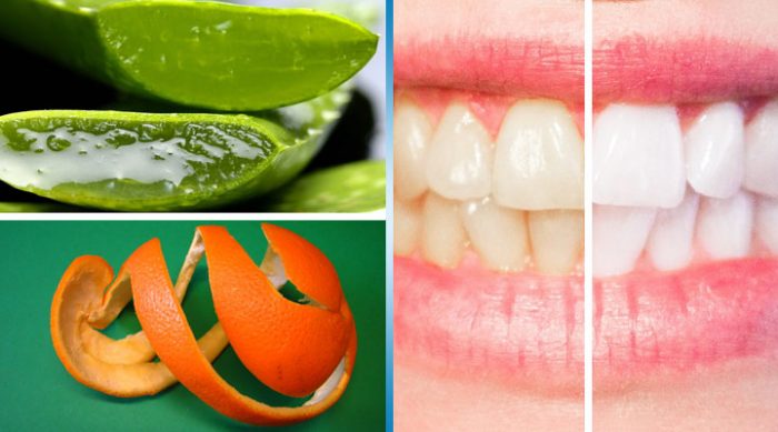 Как избавиться от зубного налета: 6 натуральных средств, которые действительно эффективны